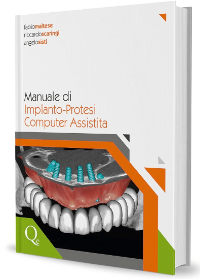 Manuale di Implanto Protesi Computer Assistita Dr. Riccardo Scaringi